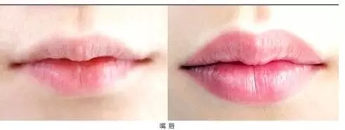 韩式半永久唇